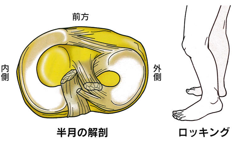 半月の解剖・ロッキングのイラスト