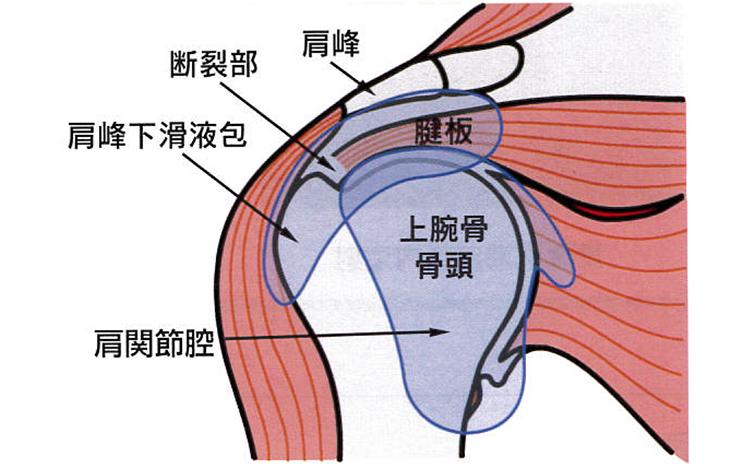 原因・病態