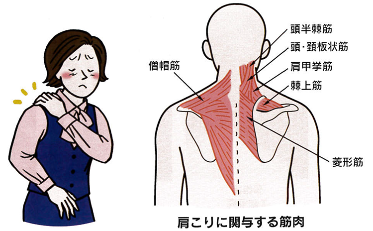 肩こりに関与する筋肉