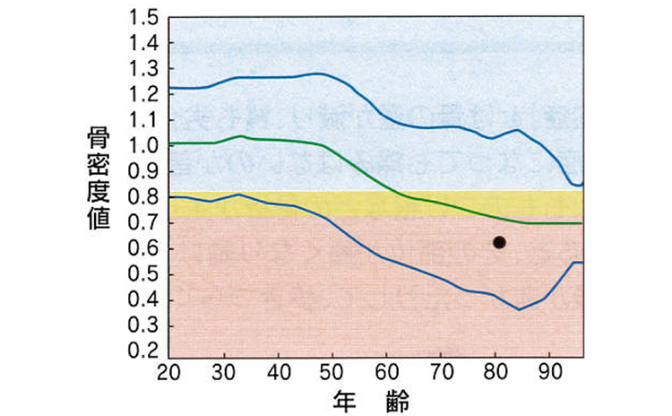 骨密度値 年齢